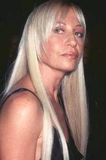 美国明星整容前后,揭秘明星美丽背后的秘密